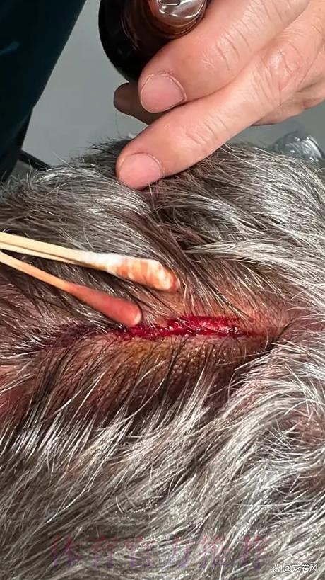 安帅:对红牌感到困扰 今天发生了我们没碰到过的事 安帅:对红牌感到困扰 今天发生了我们没碰到过的事